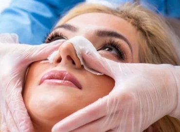 Ankara’da En İyi Burun Estetiği Doktoru Nasıl Seçilir? Bir Cerrahın Uzmanlığı Sonucu Nasıl Etkiler?